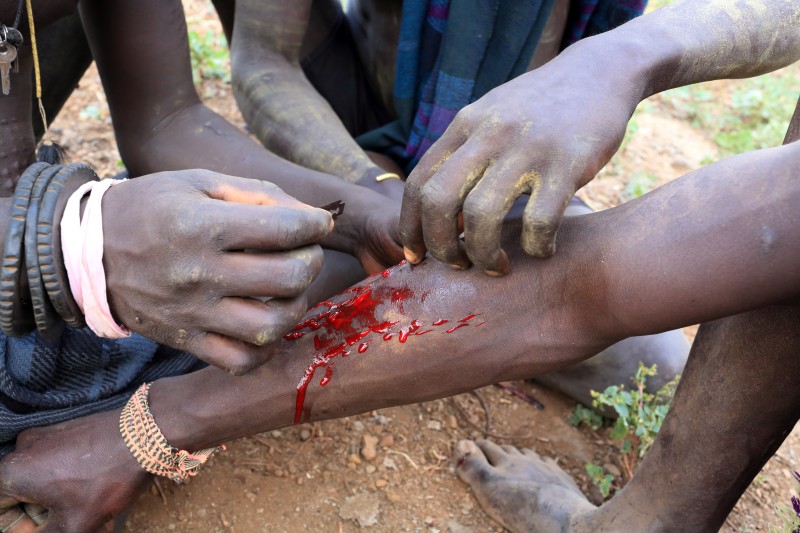 Scarification with a razor blade, Mursi tribe, Ethiopia